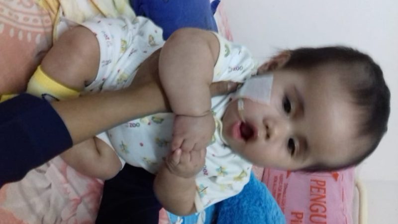 Kondisi terakhir Anggelo, bayi hidrosefalus yang kini dalam penanganan Susteran Alma