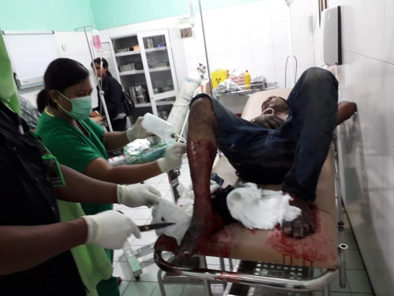 Residivis kejahatan sedang dirawat di UGD RSUD TC Hillers Maumere, Jumat (16/8) malam