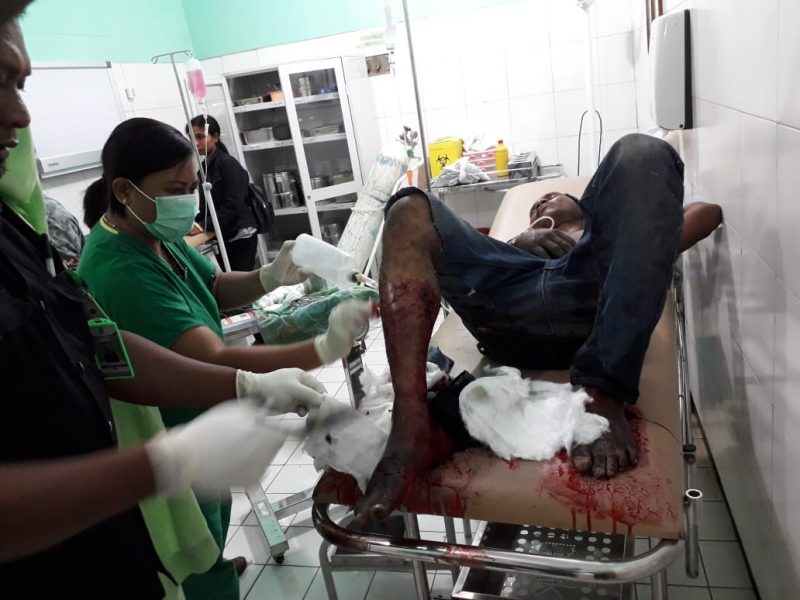 Rino mendapat perawatan di RSUD TC Hillers usai didor Tim Buser Polres Sikka pada pertengahan Agustus 2-19 lalu