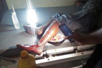 Terduga tersangka pencurian vanili mendapat perawatan di Puskesmas Bola, Senin (6/1)