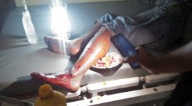 Terduga tersangka pencurian vanili mendapat perawatan di Puskesmas Bola, Senin (6/1)