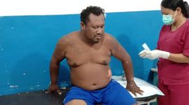 Pelaku pembakar SPBU Paga menjalani perawatan medis di Puskesmas Paga, Rabu (20/1) malam (foto: istimewa)