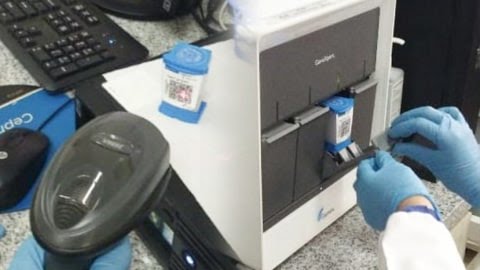Cartridge TCM pada sebuah laboratorium (foto: istimewa)