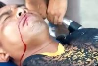 Insiden yang dialami seorang wasit usai pertandingan antara Perserond Rote Ndao dan PS Kota Kupang, Kamis (22/9) (foto: istimewa)