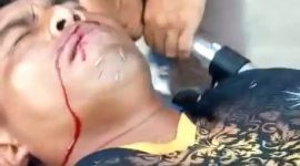 Insiden yang dialami seorang wasit usai pertandingan antara Perserond Rote Ndao dan PS Kota Kupang, Kamis (22/9) (foto: istimewa)