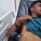 Korban Gregorius Federikus Sadin terbaring di RSUD TC Hillers Maumere dengan anak panah masih tertancap di perut bagian kanan (foto: istimewa)