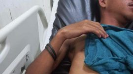 Korban Gregorius Federikus Sadin terbaring di RSUD TC Hillers Maumere dengan anak panah masih tertancap di perut bagian kanan (foto: istimewa)